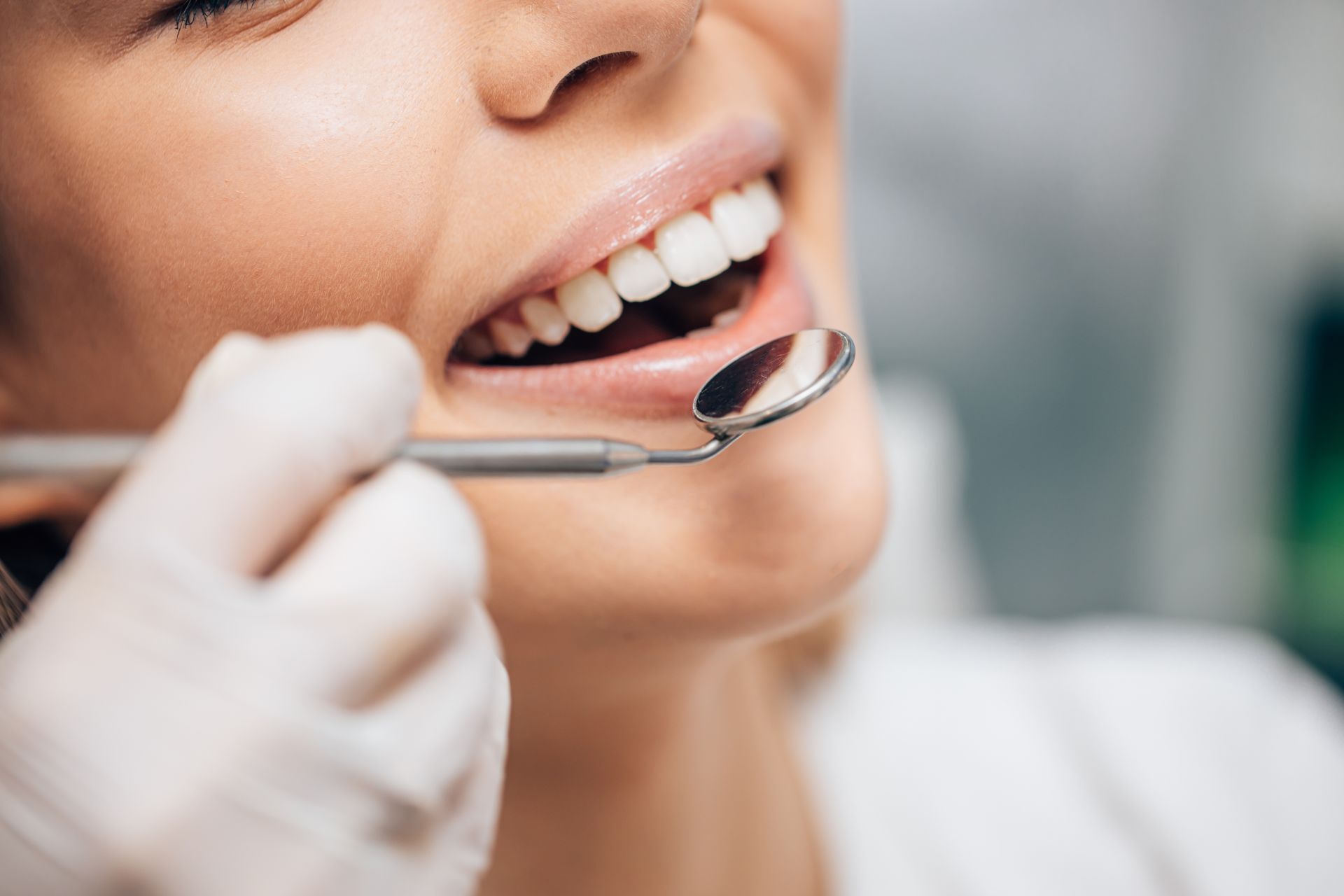 Behandlung Zahnschmelzdefekte